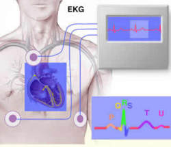 ecg.jpg